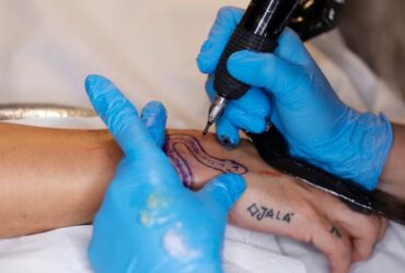 Pain Cost and Care